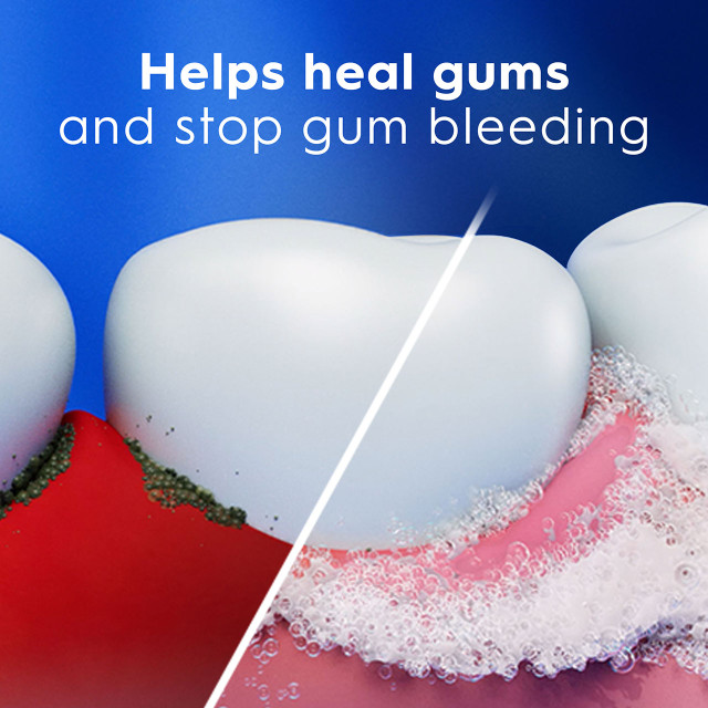 Crest Pro-Health Gum Detoxify Toothpaste, Gentle Whitening - View 2